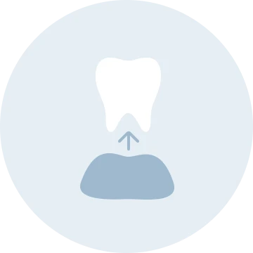 親知らずの抜歯アイコン